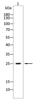 KGF Rabbit Polyclonal Antibody