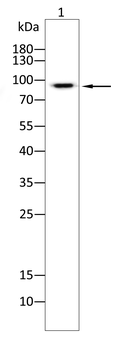 CPT1A Antibody