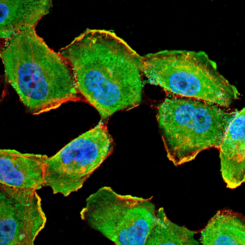EGFR Antibody