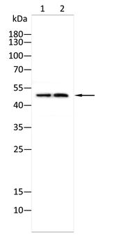 MCU Rabbit Polyclonal Antibody