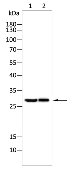 GPX8 Rabbit Polyclonal Antibody