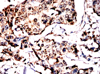 GPX8 Rabbit Polyclonal Antibody
