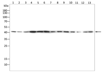 TMEM163 Rabbit Polyclonal Antibody