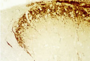 CGRP Antibody