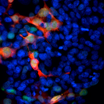 Green Fluorescent Protein Antibody