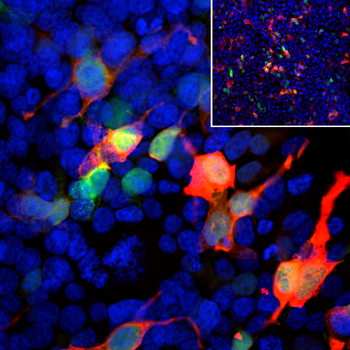 Green Fluorescent Protein (GFP) Antibody