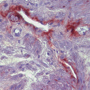 MMP9 (Matrix Mellatopeptidase 9), N terminal region Antibody
