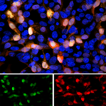 Green Fluorescent Protein (GFP) Antibody