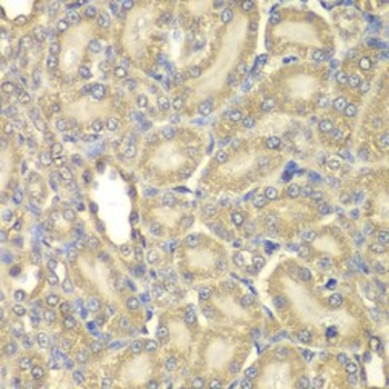 MBP (Myelin Basic Protein) Antibody