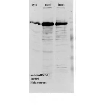 hnRNP F+H Monoclonal Antibody