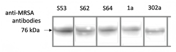 MRSA (PBP2a) Antibody (FITC)