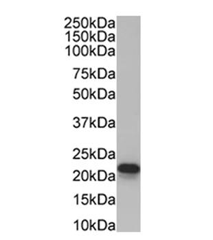 Cytochrome b245 Alpha Light Chain/p22-phox Monoclonal Antibody