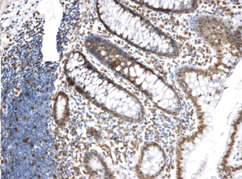 Lamin A+C Antibody (HRP)