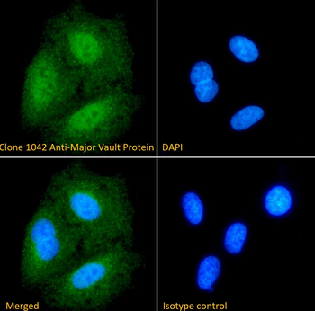 Major Vault Protein [1032], Rabbit IgG, Kappa Recombinant Monoclonal Antibody