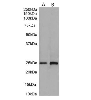 Insulin-Like Growth Factor Antibody