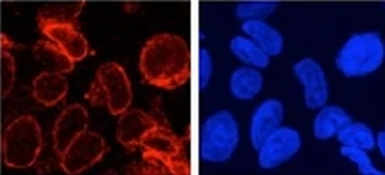 gp210 Antibody