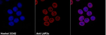 LAP2 alpha Monoclonal Antibody