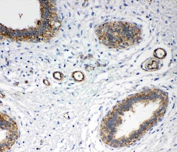 Annexin IV/ANXA4 Rabbit Polyclonal Antibody