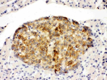 Annexin IV/ANXA4 Rabbit Polyclonal Antibody