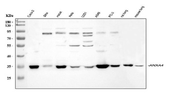 Annexin IV/ANXA4 Rabbit Polyclonal Antibody