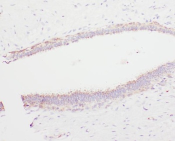 Angiostatin K1-3/PLG/K1 Rabbit Polyclonal Antibody