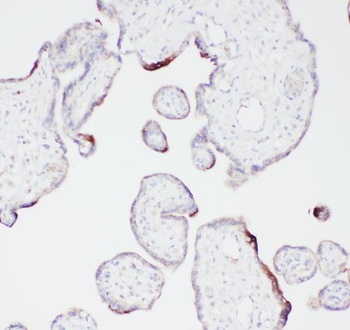 Angiostatin K1-3/PLG/K1 Rabbit Polyclonal Antibody