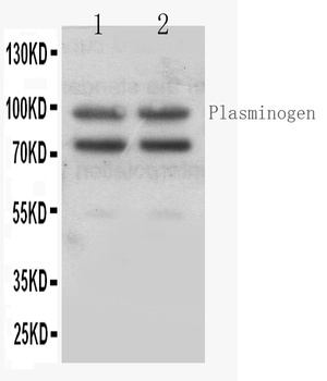 Angiostatin K1-3/PLG/K1 Rabbit Polyclonal Antibody