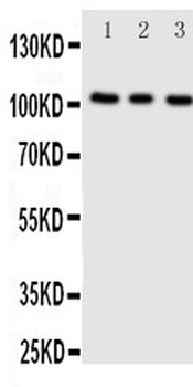 ADAMTS1 Rabbit Polyclonal Antibody