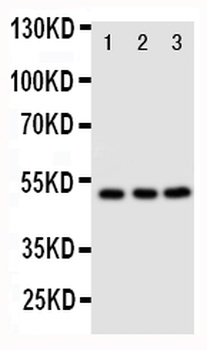 CXCR4 Rabbit Polyclonal Antibody