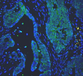 PC1/3/PCSK1 Rabbit Polyclonal Antibody