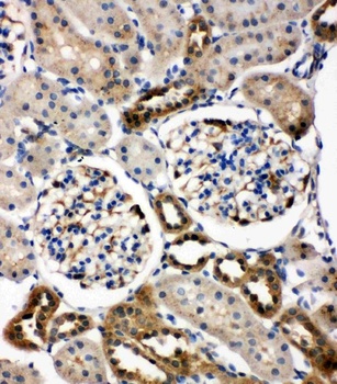 WISP1 Rabbit Polyclonal Antibody