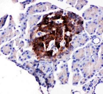 WISP1 Rabbit Polyclonal Antibody