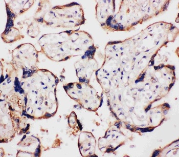 WISP1 Rabbit Polyclonal Antibody