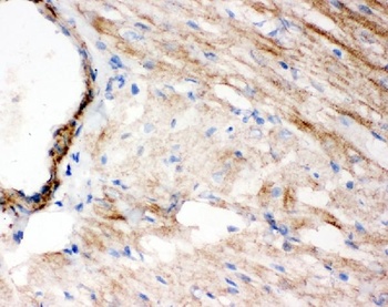 WISP1 Rabbit Polyclonal Antibody