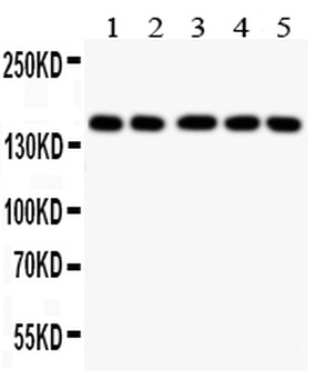 Collagen II/COL2A1 Rabbit Polyclonal Antibody