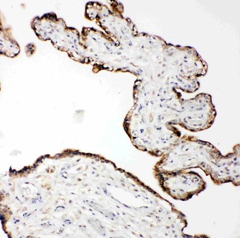 Matrix metalloproteinase-14 MMP14/14 Rabbit Polyclonal Antibody