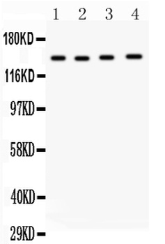 Matrix metalloproteinase-14 MMP14/14 Rabbit Polyclonal Antibody
