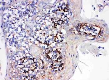 Cyclophilin B/PPIB Rabbit Polyclonal Antibody