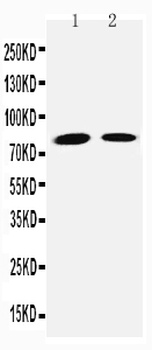 Transglutaminase 2/TGM2 Rabbit Polyclonal Antibody