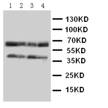 C-C chemokine receptor type 5 CCR5 Rabbit Polyclonal Antibody