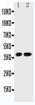 Cyclin-dependent kinase 6 Cdk6 Rabbit Polyclonal Antibody