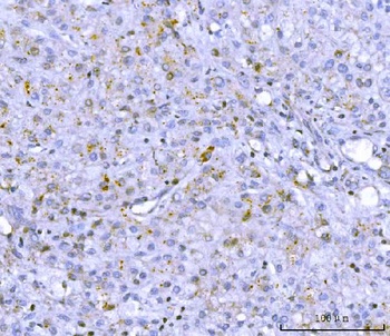 PCSK9 Rabbit Polyclonal Antibody