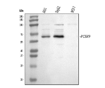 PCSK9 Rabbit Polyclonal Antibody
