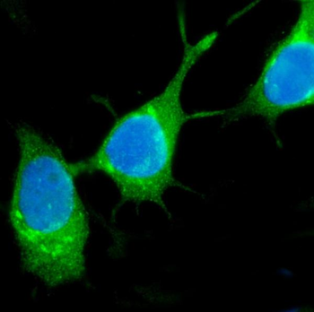 TFF1 Rabbit Polyclonal Antibody