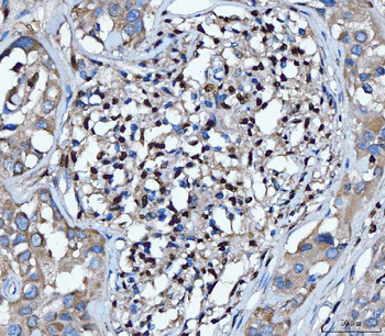 PU.1/SPI1/PU Rabbit Polyclonal Antibody