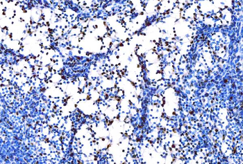 PU.1/SPI1/PU Rabbit Polyclonal Antibody