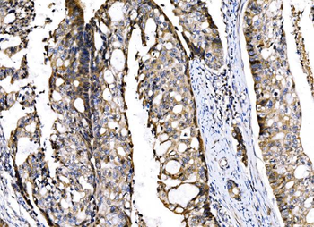 Sigma1-receptor/SIGMAR1 Rabbit Polyclonal Antibody