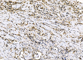 Sigma1-receptor/SIGMAR1 Rabbit Polyclonal Antibody