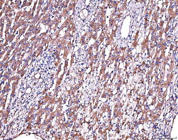 Alpha 2 Antiplasmin/SERPINF2 Rabbit Polyclonal Antibody