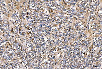 Alpha 2 Antiplasmin/SERPINF2 Rabbit Polyclonal Antibody